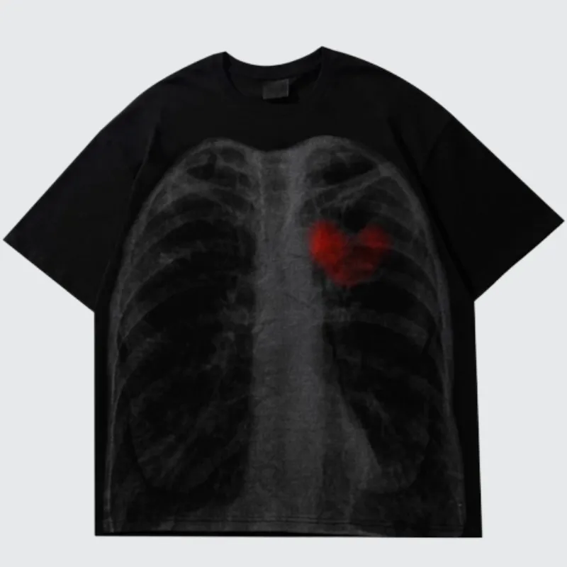 X Ray T-Shirts Designs